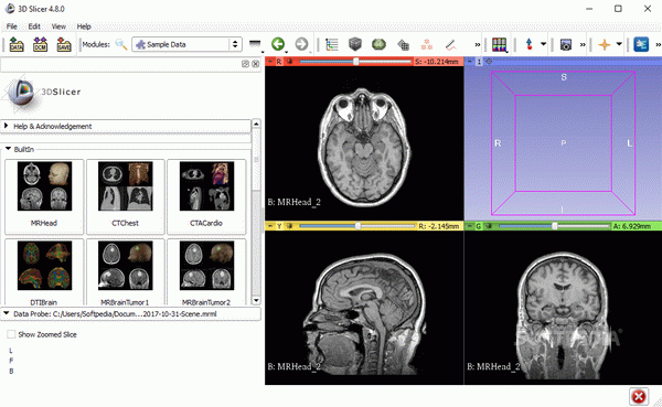 3D Slicer
