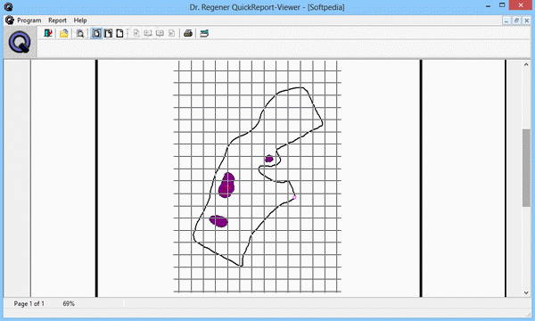 Dr. Regener QuickReport Viewer