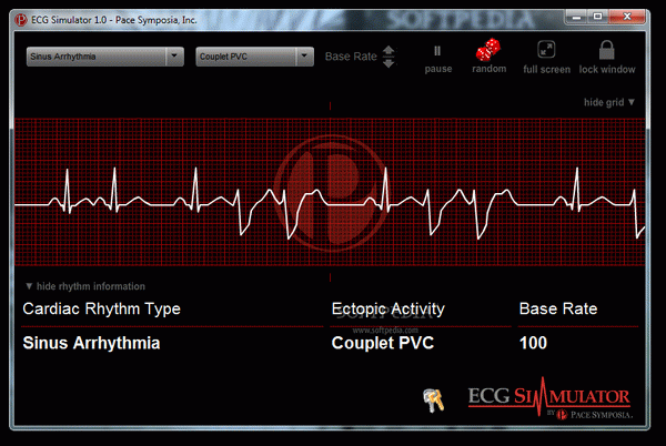 ECG Simulator