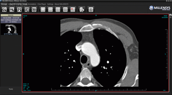 MILLENSYS DICOM Viewer