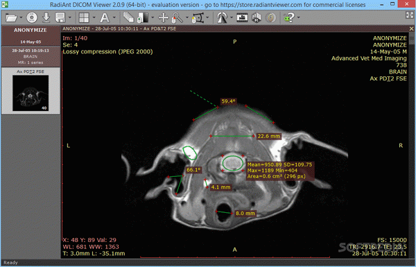 RadiAnt DICOM Viewer