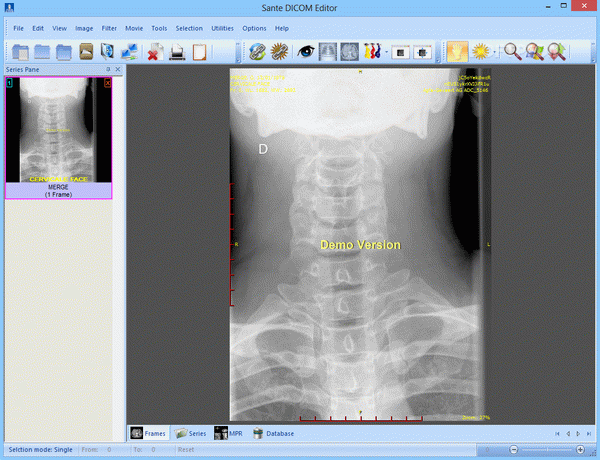 Sante DICOM Editor