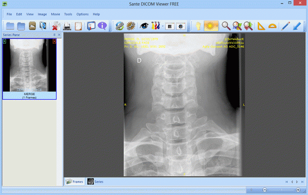 Sante DICOM Viewer FREE