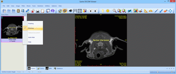 Sante DICOM Viewer Pro